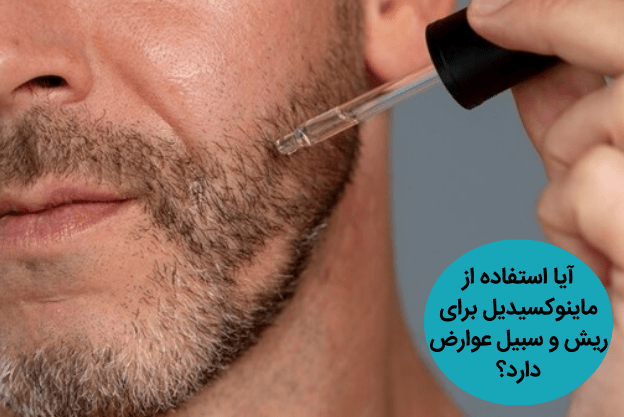 آیا استفاده از ماینوکسیدیل برای ریش و سبیل عوارض دارد؟