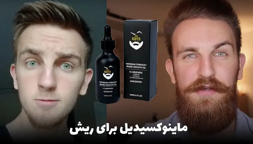 ماینوکسیدیل برای ریش