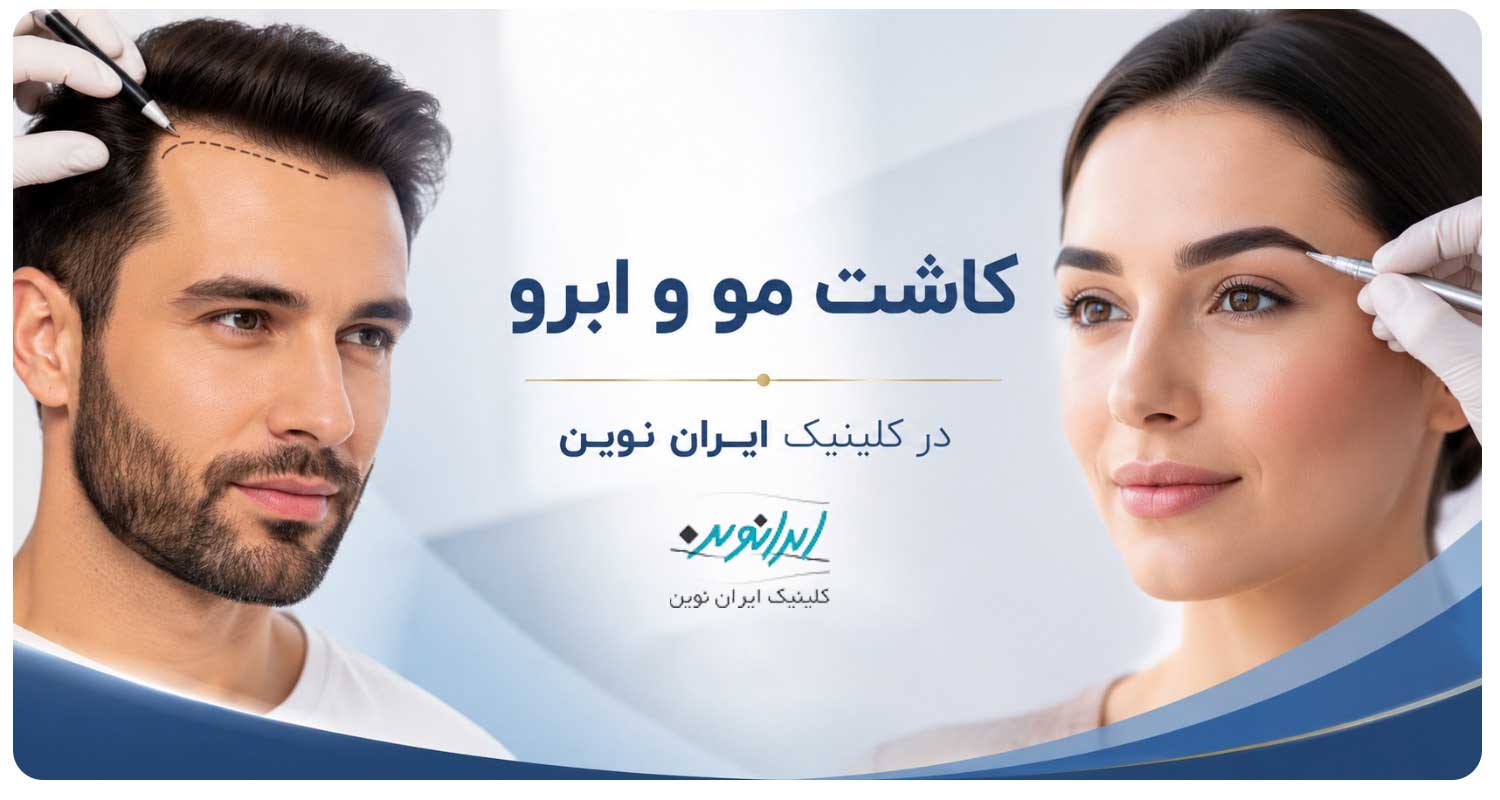 بهترین دکتر کاشت مو