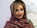 عکس هنرمند مراجعه کننده به کلینیک ایران نوین